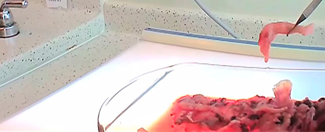 Quinto vdeo: Planned Parenthood descuartiza fetos intactos de abortos para vender rganos