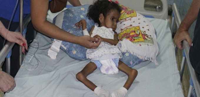 280.000 nios venezolanos en riesgo de muerte por desnutricin