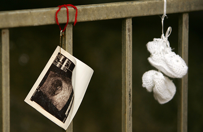 Proyecto de Ley que prohibira la mayora de los abortos en EE.UU.
