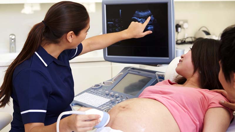 Los Caballeros de Coln donan su mquina de ultrasonido nmero 1.000 para combatir el aborto