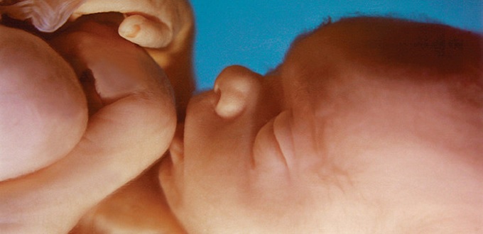 Una ciudad de Luisiana vota la prohibicin del aborto y se convierte en la primera del Estado en proteger a los bebs