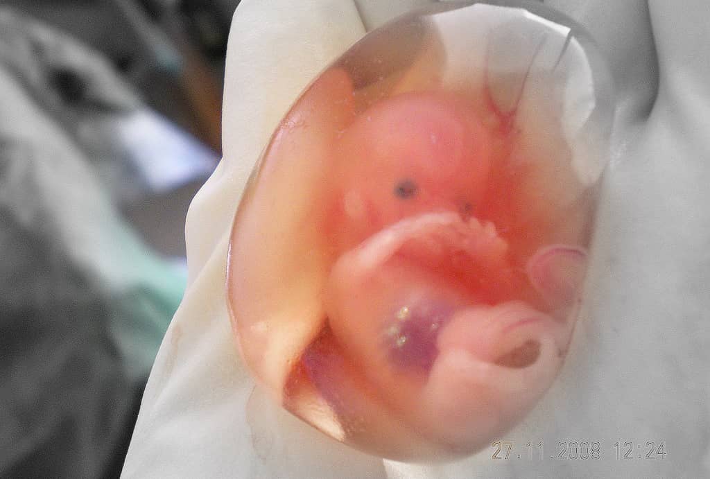 Los embriones congelados son nios: fallo sin precedentes del Tribunal Supremo de Alabama