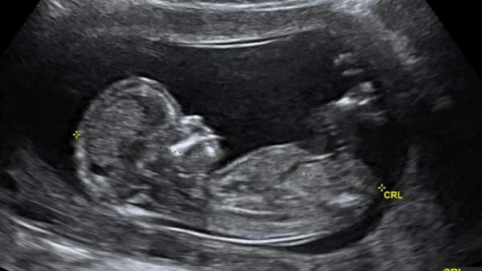 Los obispos noruegos se oponen a la liberalizacin del aborto hasta la semana 18 de embarazo