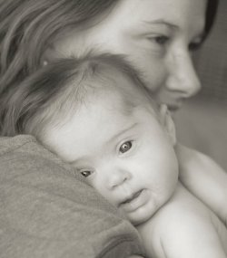 EE.UU: Abortan más del 90% de mujeres que descubren que sus hijos tienen Síndrome de Down
