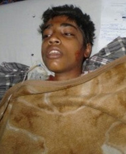 Pakistn: fallece el adolescente que fue quemado vivo por declararse cristiano