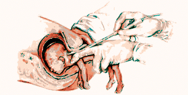 De qu hablan los abortistas cuando estn a puertas cerradas?