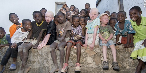 La Comisin Episcopal Justicia y Paz hace llamamiento ante la violencia contra los albinos