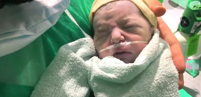 Valeria naci y fue bautizada a pesar de la presin de los mdicos que quisieron abortarla