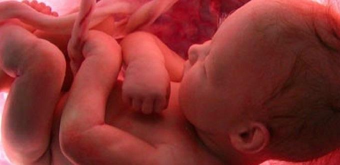 Congreso de Iowa aprueba proyecto de ley que prohíbe abortos en bebés con corazones palpitantes