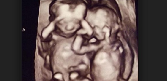 Madre embarazada de gemelos abandona una clínica abortista tras cambiar de opinión