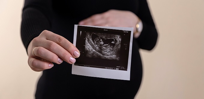 La mayora de los brasileos estn en contra del aborto