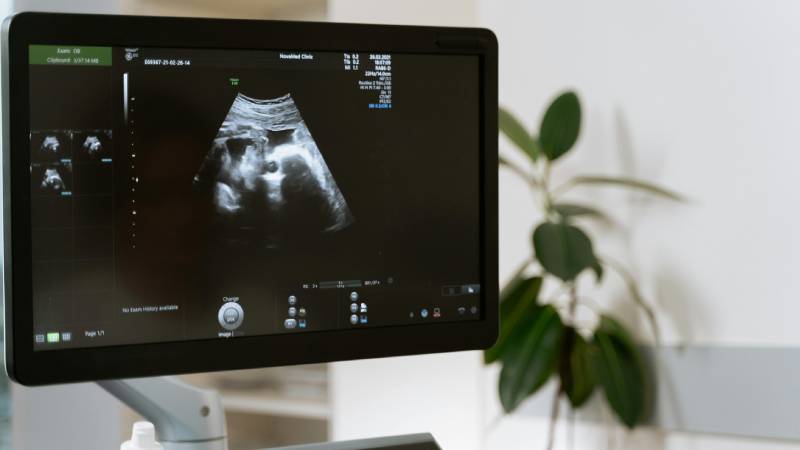 Los obispos de EE. UU. recurren el fallo que les obliga a facilitar el aborto en sus instituciones